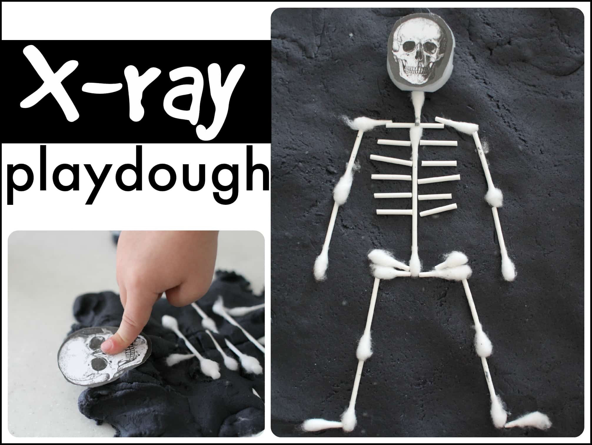 X-Ray Playdough - I Can Teach My Child!